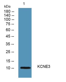 KCNE3 rabbit pAb Antibody