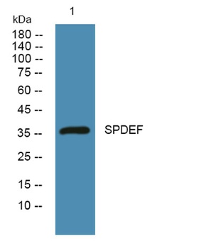 SPDEF rabbit pAb Antibody