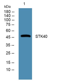 STK40 rabbit pAb Antibody