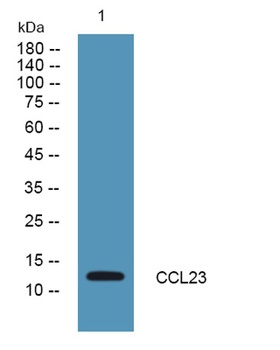 CCL23 rabbit pAb Antibody