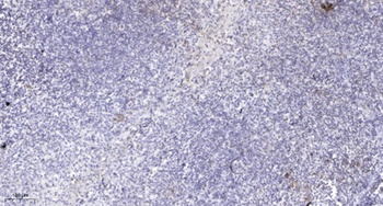 TRRAP rabbit pAb Antibody