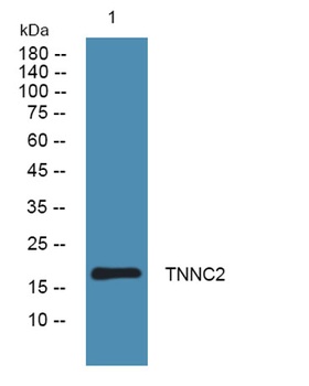 TNNC2 rabbit pAb Antibody