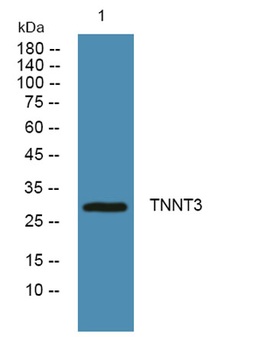 TNNT3 rabbit pAb Antibody