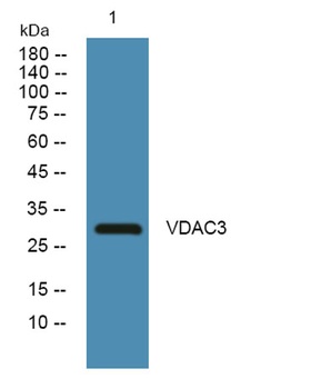 VDAC3 rabbit pAb Antibody
