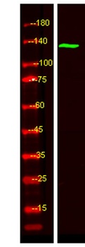 TAOK2 rabbit pAb Antibody