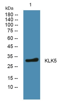 KLK5 rabbit pAb Antibody