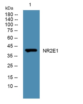 NR2E1 rabbit pAb Antibody
