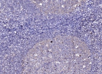 STAB2 rabbit pAb Antibody