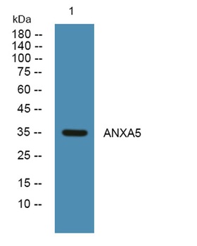 ANXA5 rabbit pAb Antibody