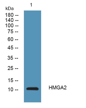HMGA2 rabbit pAb Antibody