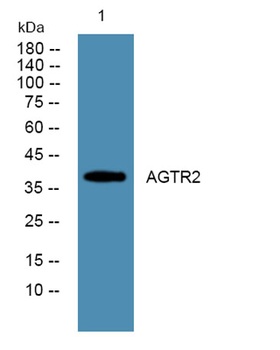 AGTR2 rabbit pAb Antibody