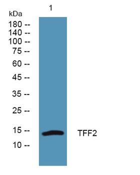 TFF2 rabbit pAb Antibody