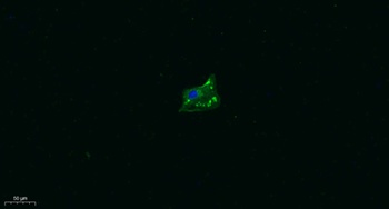 TRPA1 rabbit pAb Antibody