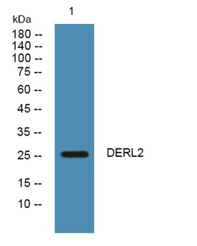 DERL2 rabbit pAb Antibody
