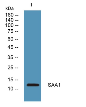 SAA1 rabbit pAb Antibody