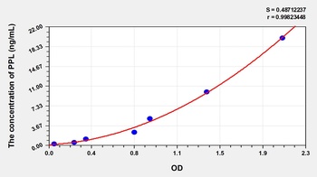 Human Periplakin (PPL) ELISA Kit