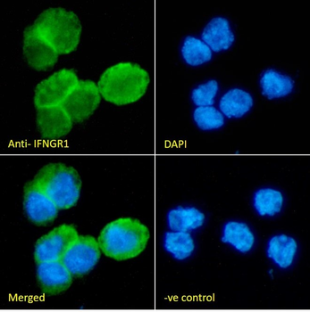 Goat anti-IFNGR1 (aa181-193) Antibody