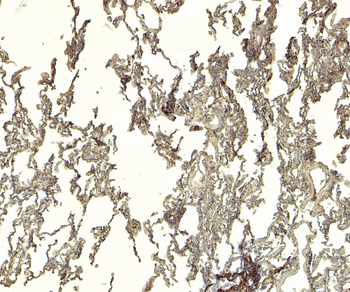 Goat anti-IFNGR1 (aa181-193) Antibody