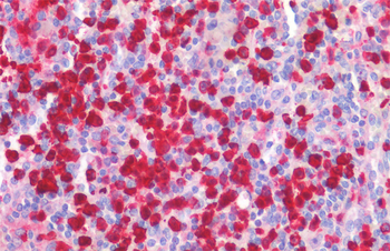 Goat anti-S100A8 Antibody