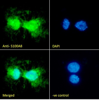 Goat anti-S100A8 Antibody