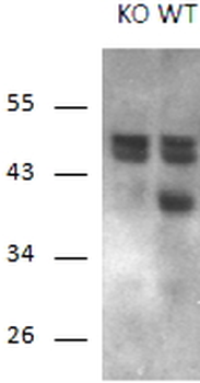 Calcipressin-1 Antibody
