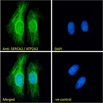 SERCA2/ATP2A2 Antibody