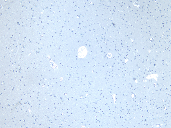 CD47 Antibody