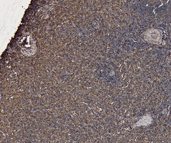 Goat anti-CD20 / MS4A1 (C Terminus) Antibody