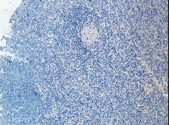 Goat anti-CD20 / MS4A1 (C Terminus) Antibody