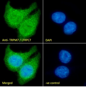 TRPM7/LTRPC7 Antibody