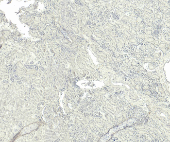 TRPM7/LTRPC7 Antibody
