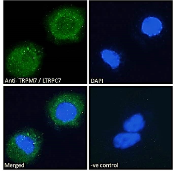 TRPM7/LTRPC7 Antibody