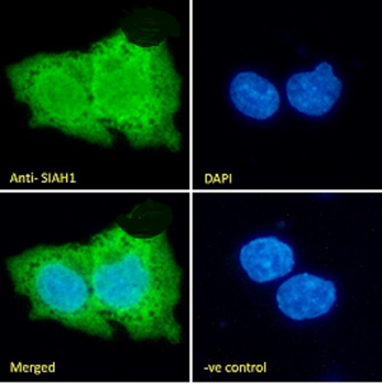 SIAH1 Antibody
