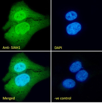 SIAH1 Antibody