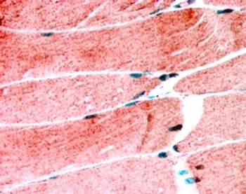 MURF1/TRIM63 (N Term) Antibody