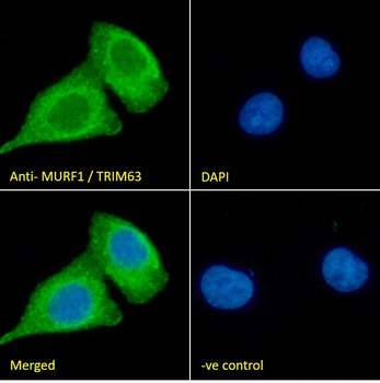 MURF1/TRIM63 (N Term) Antibody