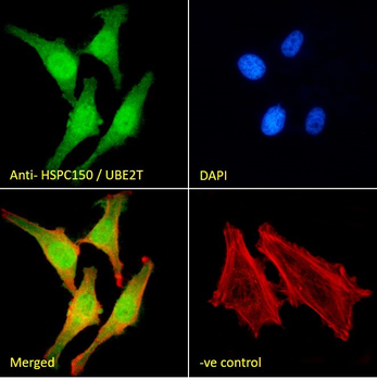 Goat anti-HSPC150 / UBE2T Antibody