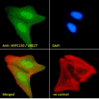 Goat anti-HSPC150 / UBE2T Antibody