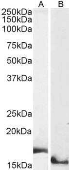 AIF1/IBA1 isoform 1 and 3 Antibody
