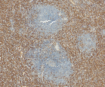 AIF1/IBA1 isoform 1 and 3 Antibody