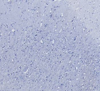 AIF1/IBA1 isoform 1 and 3 Antibody
