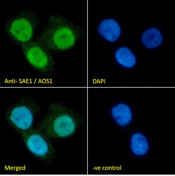 SAE1/AOS1 Antibody
