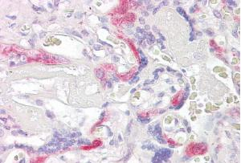 Goat anti-PHLDA2 / IPL Antibody