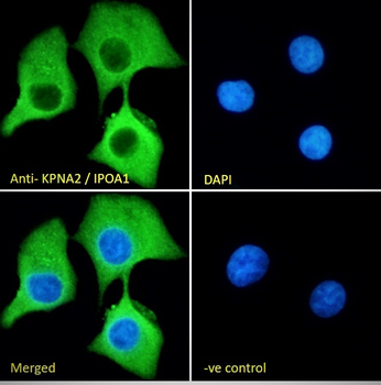 KPNA2/IPOA1 Antibody