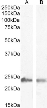 SM22 Alpha/Transgelin Antibody