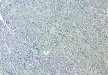 SIRT4 Antibody