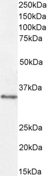 VDAC2 (C Terminus) Antibody