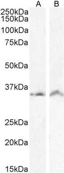 VDAC2 (C Terminus) Antibody