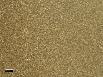 VDAC2 (C Terminus) Antibody