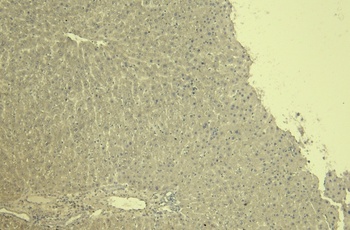 VDAC2 (C Terminus) Antibody